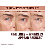EYE FILTER KIT