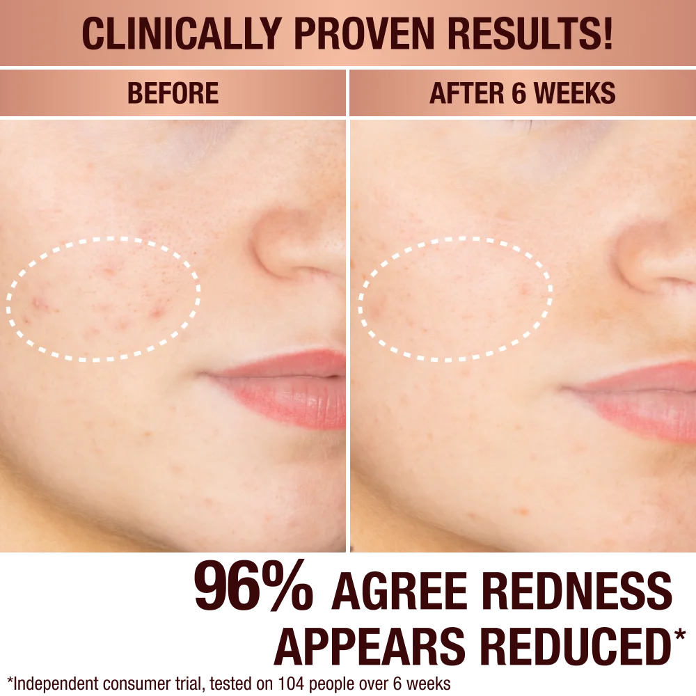 DARK SPOT CORRECTING RADIANCE RECOVERY SERUM