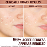DARK SPOT CORRECTING PROTECT, HYDRATE & GLOW KIT