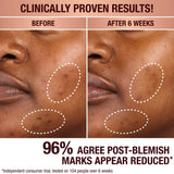 DARK SPOT SERUM & MINI CHARLOTTE’S MAGIC CREAM DUO